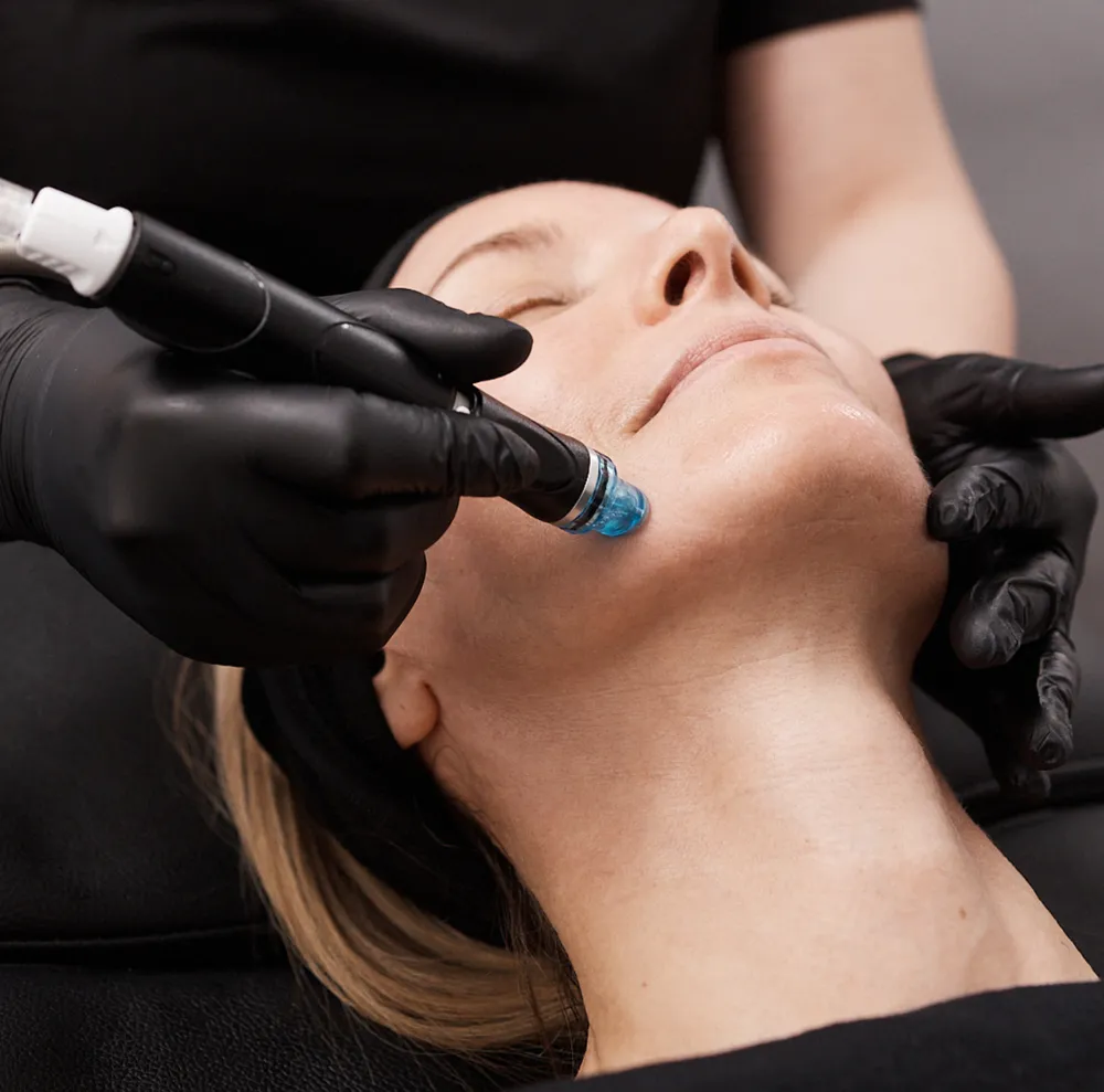 HydraFacial handpiece used during a facial treatment